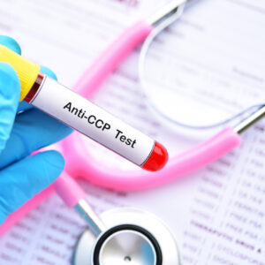 Anti CCP Antibody